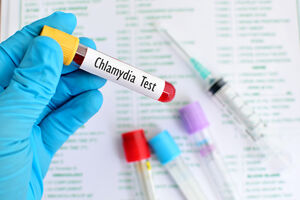 Chlamydia to bakteria wywołujaca chorobę, chlamydiozę