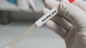 mpox
