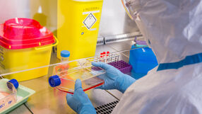 Z HIV żyje nawet 35 tysięcy Polaków