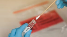 Covid-19 test