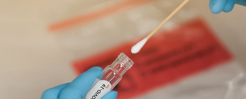 Covid-19 test