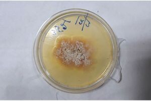 Medical Mycology Case Reports