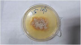 Medical Mycology Case Reports