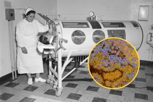 Chory na polio, wirusy polio