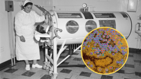 Chory na polio, wirusy polio