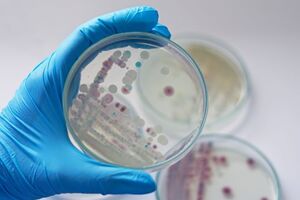 Vibrio vulnificus