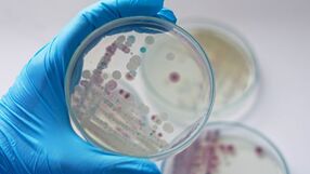 Vibrio vulnificus