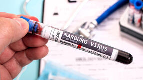 wirus Marburg