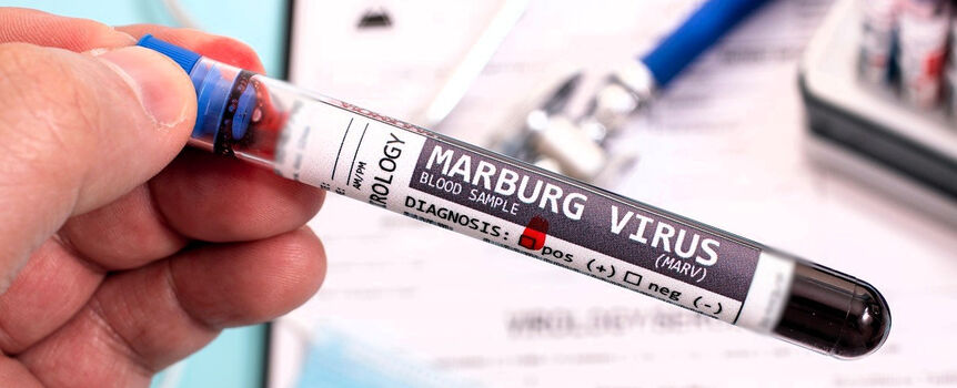 wirus Marburg