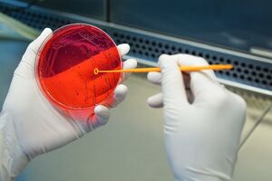 Zmutowana bakteria K. pneumoniae w 16 krajach na świecie