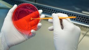 Zmutowana bakteria K. pneumoniae w 16 krajach na świecie
