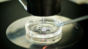 Metoda in vitro