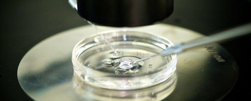 Metoda in vitro