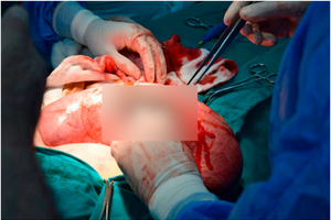 Annals of Medicine and Surgery