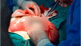 Annals of Medicine and Surgery
