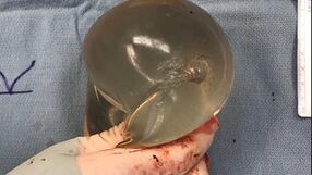 Implant piersi