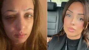 38-latka straciła wzrok po wizycie na basenie