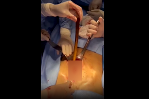 Endoscopy