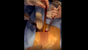 Endoscopy
