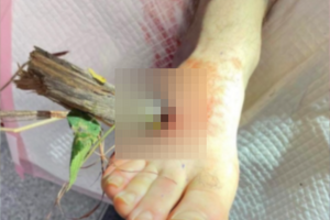 STOP The Bleed - Polska/Facebook