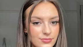 20-latka przeszła udar. Wymienia jeden ważny objaw