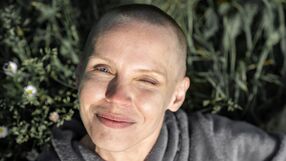 Tak chemioterapia wpływa na mózg: 7 objawów