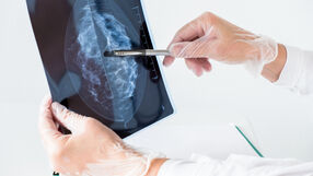 Lekarz ogląda zdjęcie po mammografii
