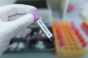 Mutacje w genach BRCA1 i BRCA2 mogą powodować raka prostaty