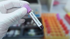 Mutacje w genach BRCA1 i BRCA2 mogą powodować raka prostaty