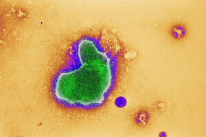 Respiratory Syncytial Virus (RSV)