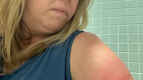 Odczulanie. Alergia na jad owadów