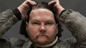AP/Associated Press/East News