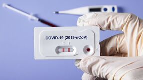 Test na COVID-19