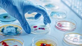 Jak leczyć infekcje oporne na antybiotyki? Naukowcy odkryli sposób