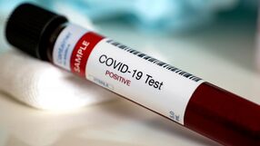 Nowy test na COVID-19