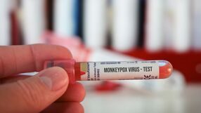 Test na małpią ospę