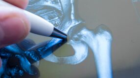 Endoprotezy stawów diagnostyka