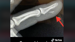hand.doc/ TikTok