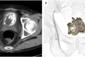 Urology Case Reports/sciencedirect.com