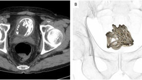 Urology Case Reports/sciencedirect.com
