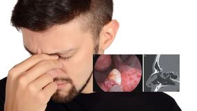 Shutterstock/NEJM