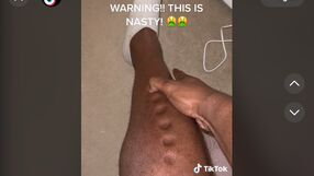 Lawrence Okoye/TikTok