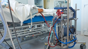 ECMO