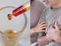 Nadużywanie płynu Lugola grozi arytmią i udarem