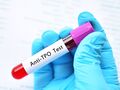 Badanie anty-TPO - diagnostyka chorób tarczycy