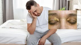 Objawy wysokiego cholesterolu