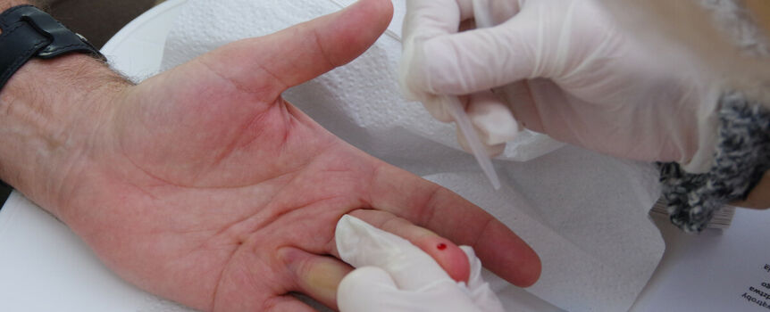 Bezpłatny test na HCV od 1 lipca u lekarza rodzinnego