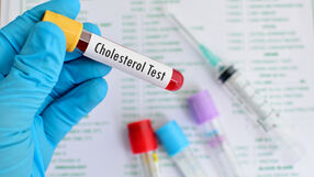 Przyczyny wysokiego cholesterolu