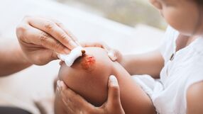 Jak nie odkażać ran? 6 najgorszych środków