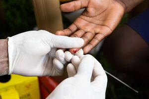 Shutterstock/Badanie na HIV